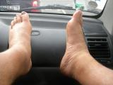 Swollen feet