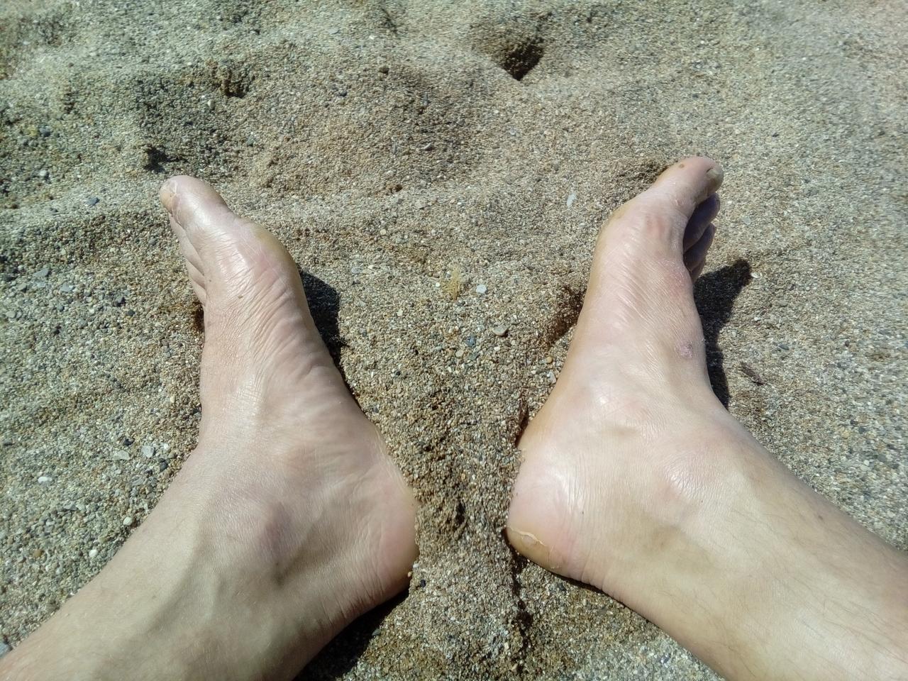 Feet, the day after.